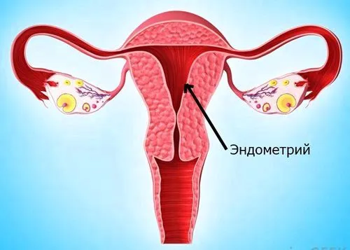 як лікувати гипопластический ендометрій