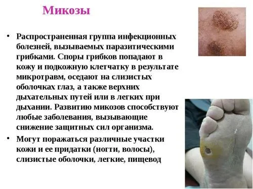 як лікувати кандидоз шкіри голови