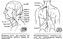 міжреберна невралгія симптоми і лікування в домашніх умовах