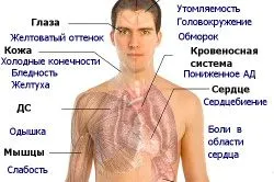 Нормохромнаяанемія як лікувати нормохромнаяанемія