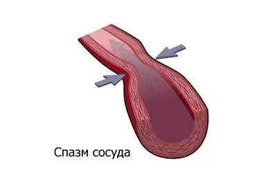 ніж лікувати судини голови