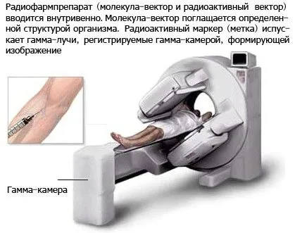 як лікувати забій шийки стегна