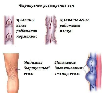 велика