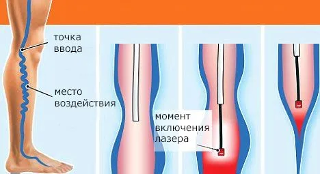 велика