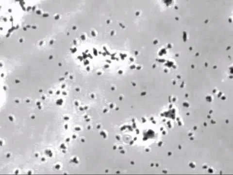 mycoplasma genitalium це жінка