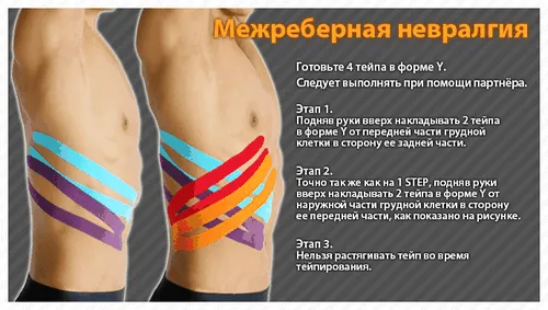 невралгія лікувати вдома