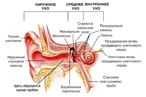 гострий середній отит