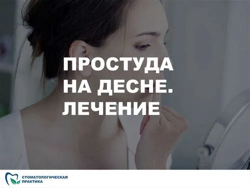 Лікувати застуду на яснах лікування ясен