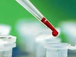 ніж лікувати токсоплазмоз у жінок