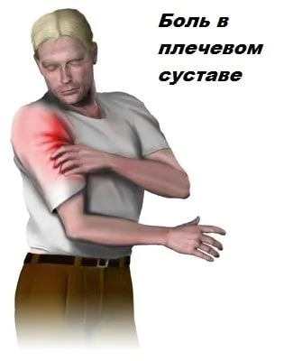 Тендиніт сухожилля біцепса: причини, симптоми, діагностика, лікування як лікувати розтягнення біцепса