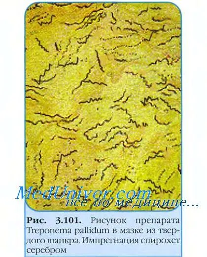 лікування сифілісу порожнини рота