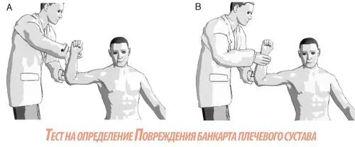 пошкодження банкарта плечового суглоба лікування
