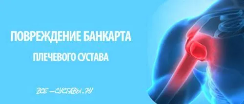 лікувати забій плечового суглоба