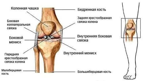 розтягнення зв'язок колінного суглоба