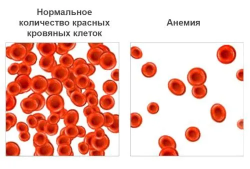 здоров'я дитини