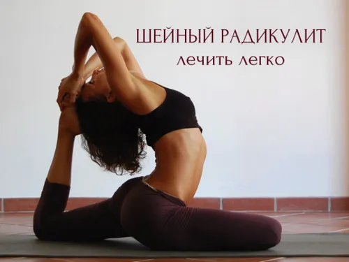 препарати від шийного радикуліту