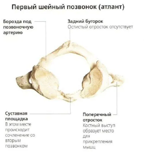 як лікувати вивих шиї в домашніх умовах