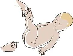 як лікувати запор у немовляти