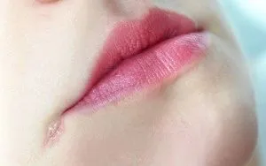 тріщини в куточках губ