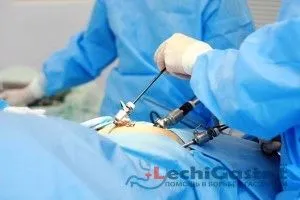 як лікувати жовч в шлунку