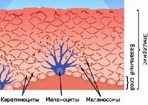 лікувати вітіліго назавжди