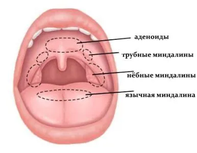 як лікувати гланди у дитини народними засобами