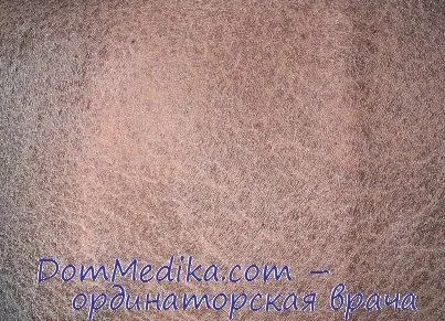 лікувати вульгарний іхтіоз