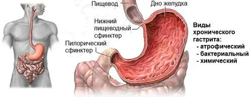 симптоми