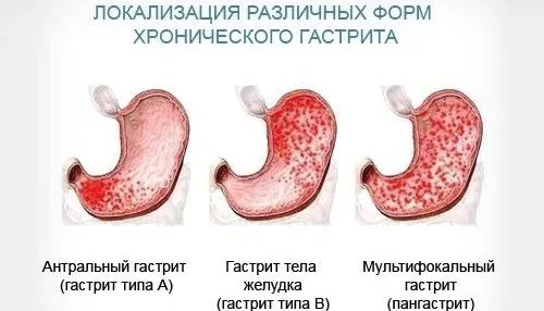 дієта