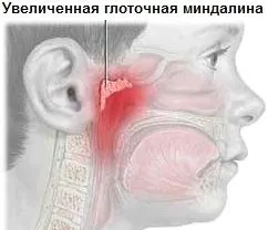 інтернет фітоклініки народна медицина.