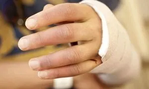 як лікувати розтягнення лучезапястного суглоба