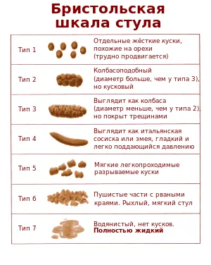 причини запору