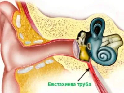 як лікувати тубоотит у грудничка