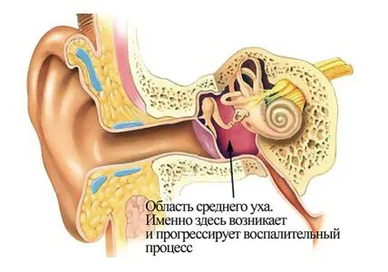 хронічний нежить і чхання