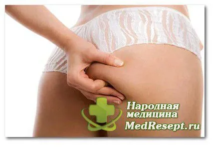целюліт причини