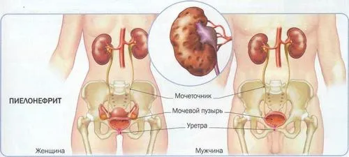 як лікувати нирки в домашніх умовах