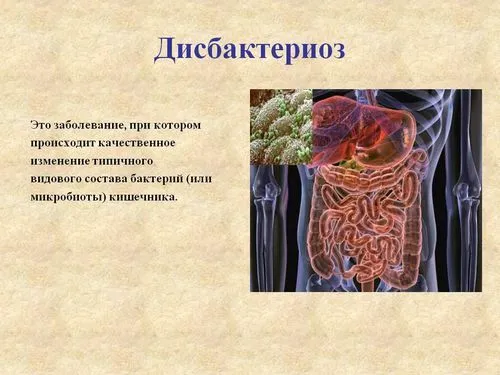 захворювання