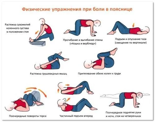 як лікувати остеохондроз фізичними вправами