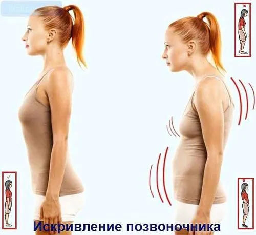 постава