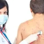 Лікування дерматиту у дітей як лікувати контактний дерматит у дітей