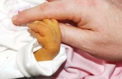 як лікувати каротинового жовтяницю