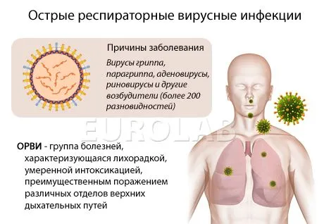 як лікувати ГРВІ при вич