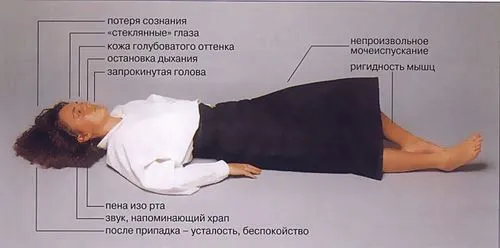 лікування епілепсії дітей дитини симптоми скронева роландична криптогенная реабілітація перша допомога напад прогноз можна вилікувати види идиопатическая нічна лобова фокальна проявляється сні робити причини виникнення народними засобами препарати Укаїни москві перші ознаки лікувати діагностика