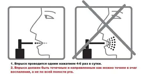 як лікувати стоматит люголем
