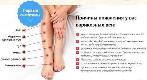 як лікувати сильний варикоз