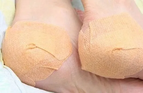 як лікувати шпору жовчю