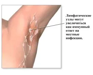захворювання