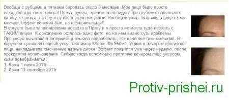як лікувати прищі яблучним оцтом