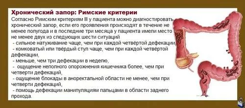 стілець