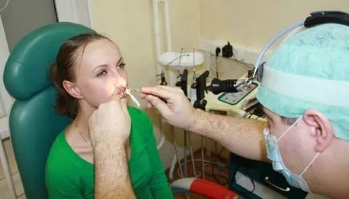 хронічний ексудативний гайморит